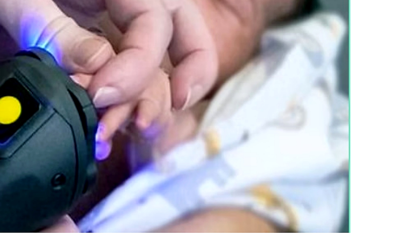 Exemplo de captura biométrica neonatal presente no material técnico